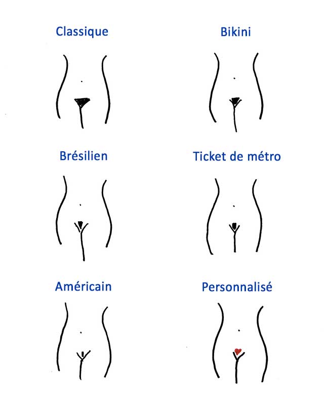 formes d'épilation du maillot