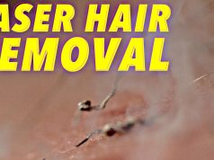 L’épilation au laser, comment ça marche ? Voyons cela au ralenti !