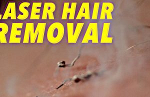 L’épilation au laser, comment ça marche ? Voyons cela au ralenti !