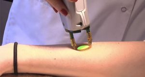 Enquête sur l’épilation définitive au laser et à la lumière pulsée épilation au laser sur l'avant-bras