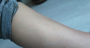 La lumière pulsée, j’ai testé, je vous raconte ! mollet après lumière pulsée