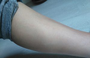 La lumière pulsée, j’ai testé, je vous raconte ! mollet après lumière pulsée